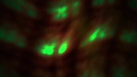 Fluorescent Cells Under Microscope Closeup. Stock Footage 335353415
