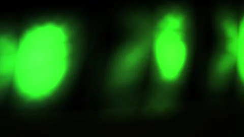 Fluorescent Cells Under Microscope Lens. Stock Footage 334521457