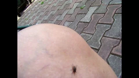 A fly is crawling on my leg Stock Footage 344048263