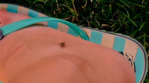 Fly on the leg. Selective focus. Stock Footage 295479792