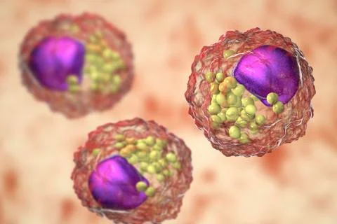 Foam cell, macrophage cells that contain lipid droplets Stock Illustration