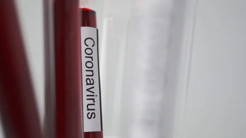 Focus changing from coronavirus to covid-19 test tube, pandemic concept Stock Footage 127610315
