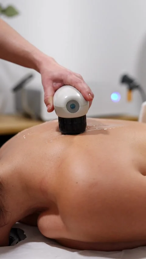 Focused Shockwave Therapy Application on Patient's Lower Back Stock Footage 271350950