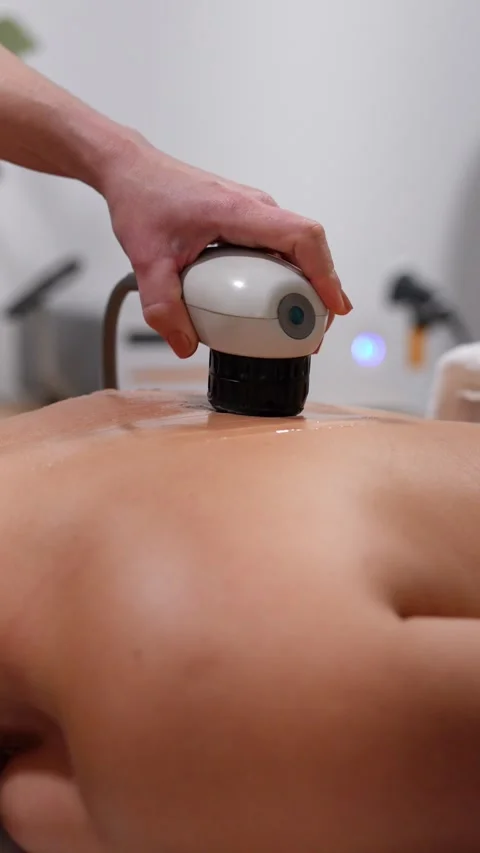 Focused Shockwave Therapy Application on Patient's Lower Back Stock Footage 271351076