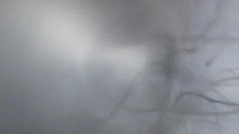 Focusing lint threads through an optical microscope Stock Footage 331531341