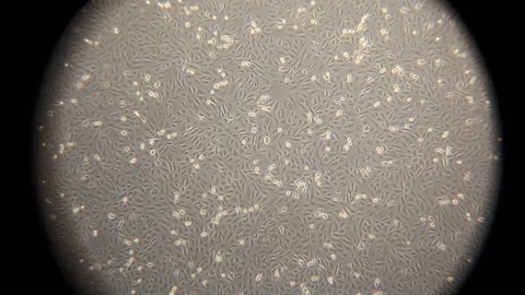 Focusing with an optical microscope on a layer of human cancer cells Stock Footage 126279689