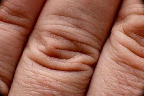 Folds of skin on the fingers close up. Stock Photos