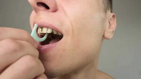 Food stuck between teeth. A man uses dental floss to remove the food, focusing Stock Footage 295929841