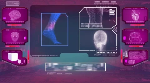 Foot Analysis  - High Tech Scan - Pink 01 Stock Footage 58506187