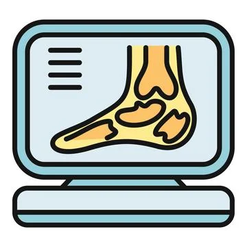 Foot bone x ray scan on monitor displaying medical diagnosis 스톡 일러스트