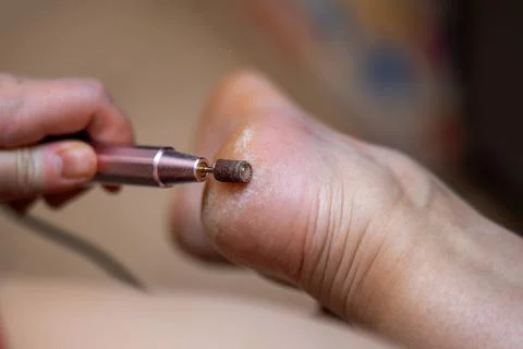 Foot care session, showcasing an automatic device with an abrasive attachme.. Stock Photos