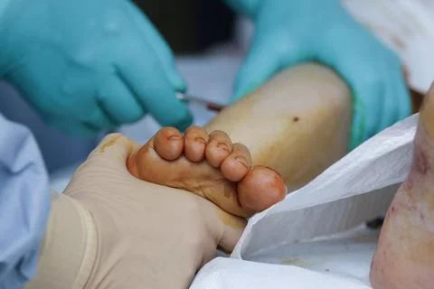Foot Close-up At Surgery Photos