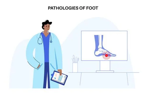 Foot pathologies poster Illustrazione stock
