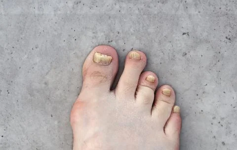Foot Stock Photos