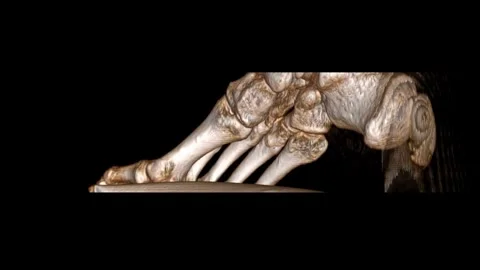 FOOT Plain Bone Thin-VR-movie Stock Footage 285255737