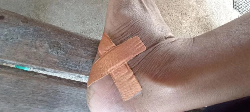 Foot plaster Foto stock