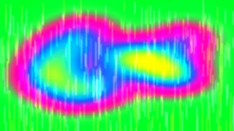 Foot Pressure Map Analysis Showing Gait Distribution and Plantar Load Stock Footage 333082213