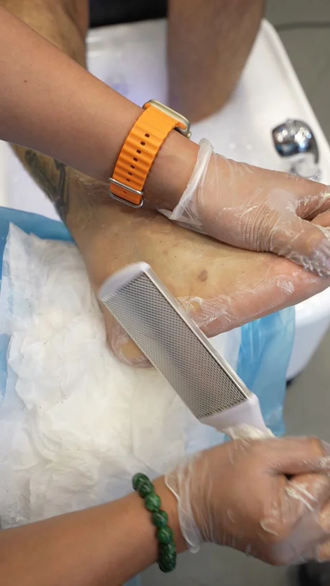 Foot Treatment in Progress Stock Footage 314901496