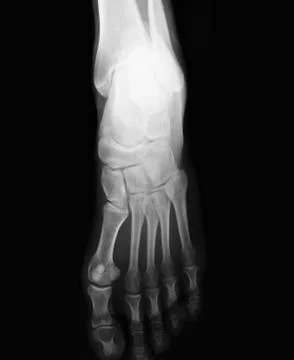 Foot  xray Foto stock