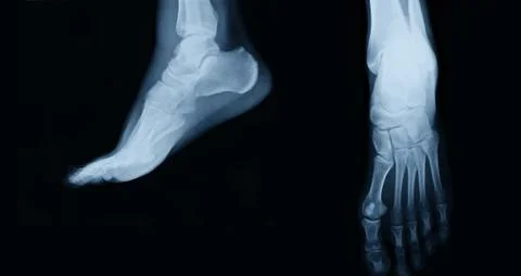 Foot  xray Fotos Stock