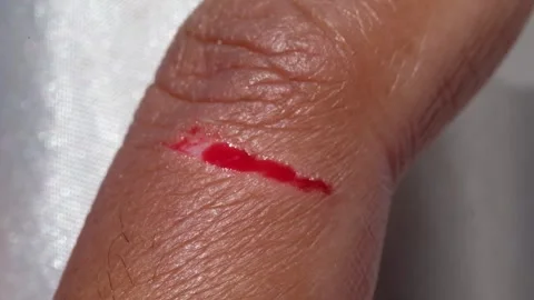 Footage of a brown-skinned man&amp;#039;s bleeding index finger. Stock Footage 315927248