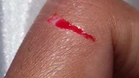 Footage of a brown-skinned man&amp;#039;s bleeding index finger. Stock Footage 315927392