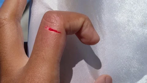 Footage of a brown-skinned man&amp;#039;s bleeding index finger. Stock Footage 315927566