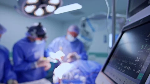Footage near the screen of lung ventilating machine. Medical team works at Stock Footage 333337034