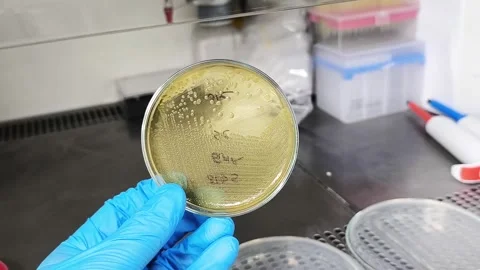 Footage of Proteus bacteria, a type of gram-negative bacteria Video stock 337722886