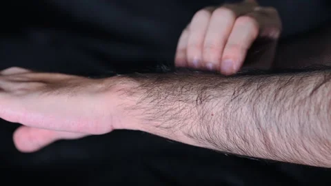 Forearm Skin Irritation and Itching Medical Concept Stock Footage 337785168
