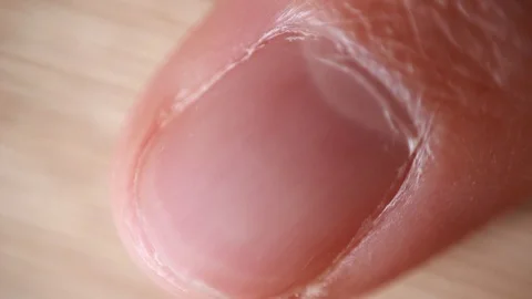 Forefinger nail macro focus 動画素材 86509411