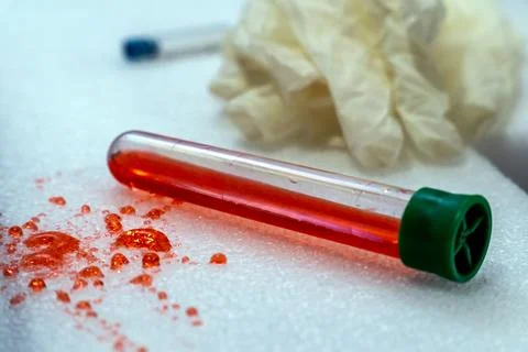 Forensic Analysis in Action Test Tube, Blood, and Criminology 3 Stock Photos