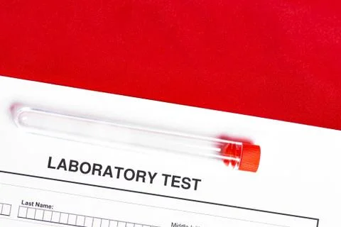 Form to fill in with results of empty test in tube Stock Photos