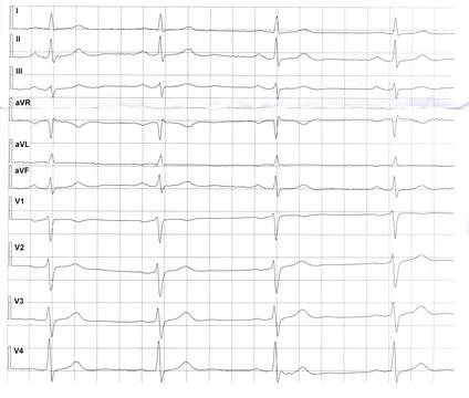 Form with recording of electrocardiogram (ECG) Stock Illustration