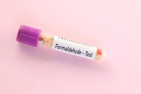 Formaldehyde test, food sample to analyze in the laboratory Stock Photos