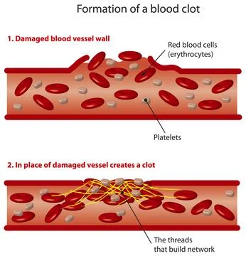 Formation of a blood clot Illustrazione stock