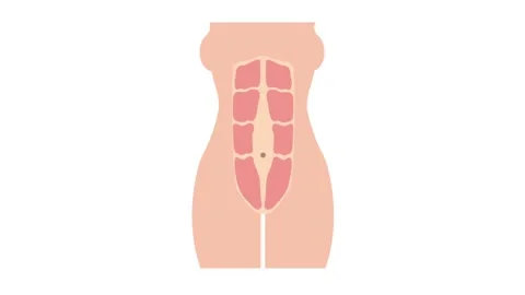 Formation of diastasis recti animation Stock Footage 164884236