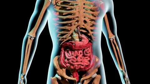 Formation of an Ulcer in the Stomach 스톡 동영상 136554483