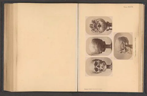 Four images of a samic men s skull; Cranio Lappone, di Kautokeino â, N.  Stock Photos