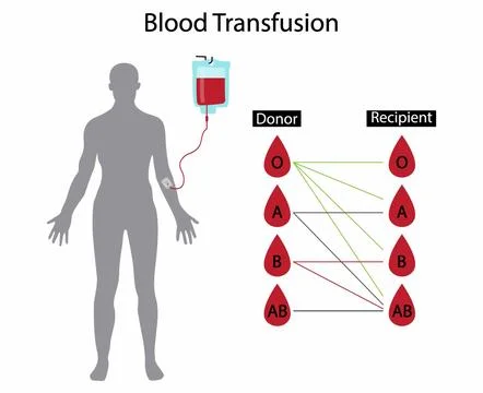 Four major blood groups, Donate blood Stock Illustration