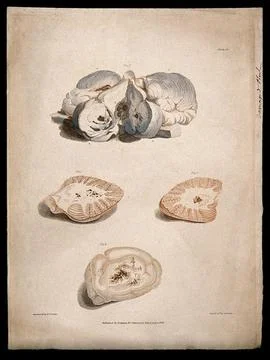 Four sections of diseased brain. Colour stipple etching by C. J. Canton aft.. Stock Illustration