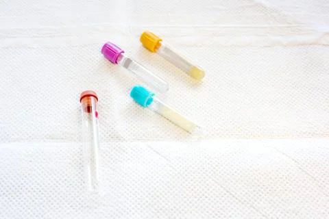 Four test tubes on a disposable pad Fotos Stock