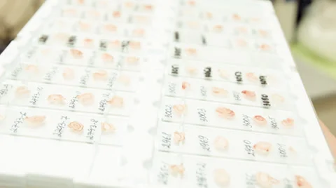 Fox teeth samples in the lab Vidéo 37344988