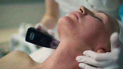 Fractional Radiofrequency System for Precise and Effective Treatment of Stock-Footage 267063183
