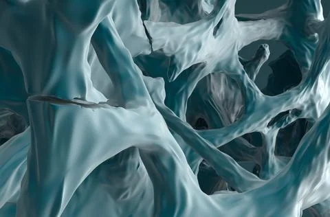 Fracture bones in osteoporosis Stock Illustration