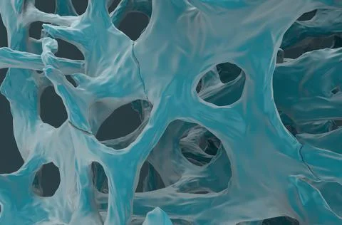 Fracture bones in osteoporosis 스톡 일러스트