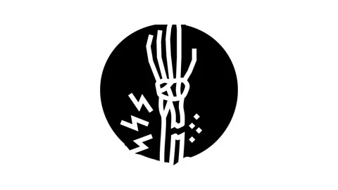 Fracture forearm bones osteoporosis glyph icon animation Stock Footage 326150968