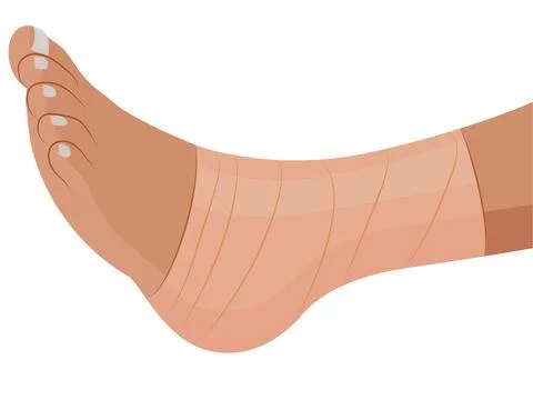 Fractured Leg Stock Illustration