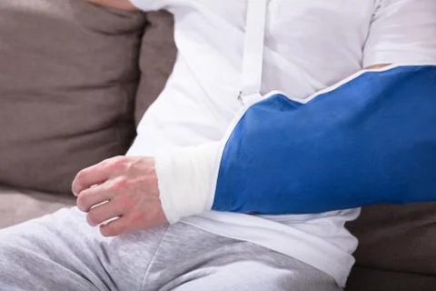 Fractured Man's Hand Stock Photos