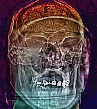 FRANKENSTEIN Stock Photos